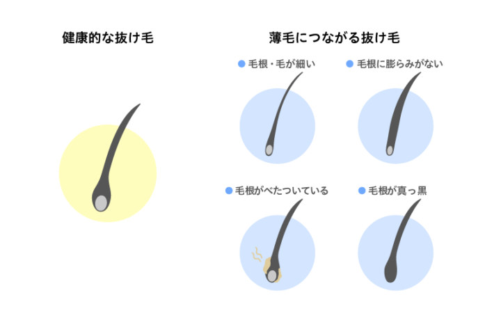 抜け毛の種類見分け方